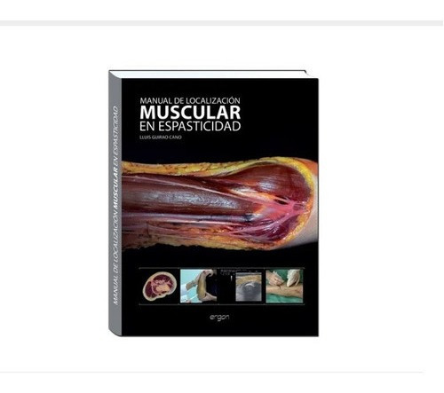 Manual De Localizacin Muscular En Espasticidad,jk
