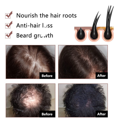 Barra De ChampĂș Fallopia Multiflora Para Cabello Negro Y
