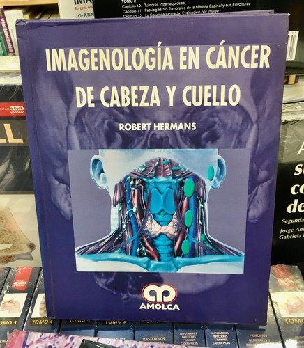 Imagenología En Cáncer De Cabeza Y Cuello