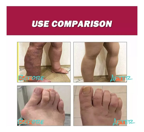 // 3 Bálsamos De Masaje Para Las Articulaciones Care Relief