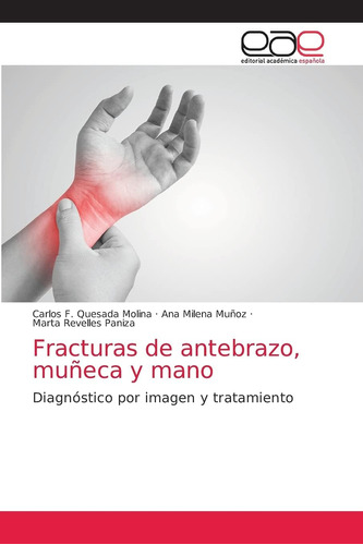 Libro: Fracturas Antebrazo, Muñeca Y Mano: Diagnóstico Po