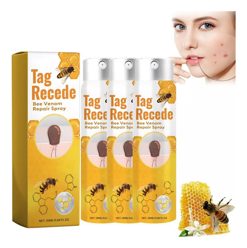 3 Unidades De Aerosol Verrugas Of Abeja Veneno De 20 Ml