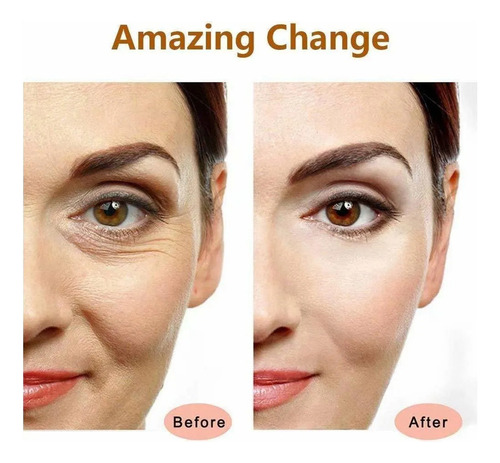 // Rodillo Masajeador Facial Eléctrico Rodillo Facial Dorado