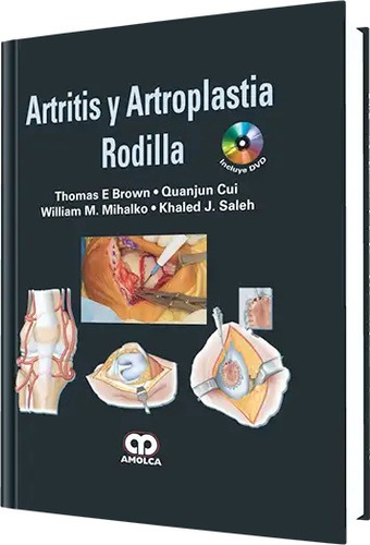 Artritis Y Artroplastia. Rodilla  Brown