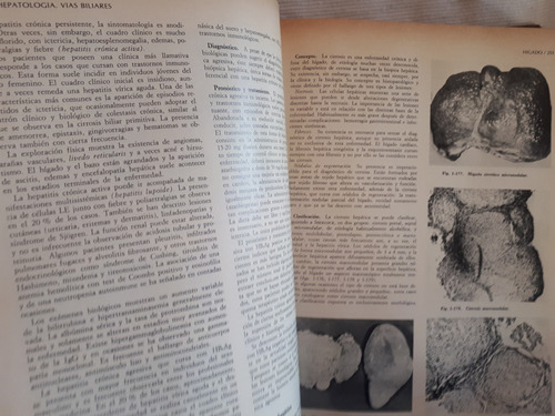 Imagen 7 de 9 de Medicina Interna 2 Tomos Rozman & Farreras Marin Tapa Dura