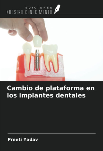 Libro: Cambio De Plataforma En Los Implantes Dentales (spani