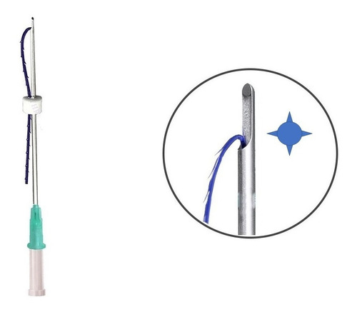 Imagen 2 de 4 de Hilos Tensores Espiculados 4d, Con Cannula En L