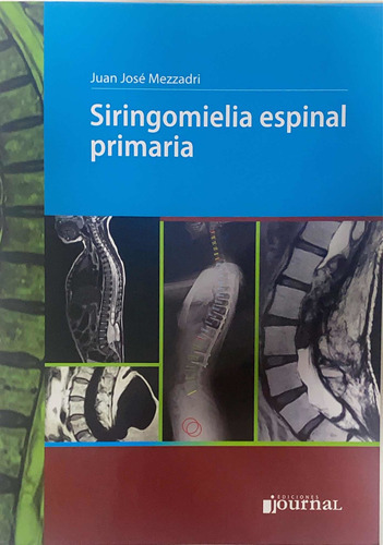 Mezzadri Siringomielia Espinal Primaria Novedad Envíos 