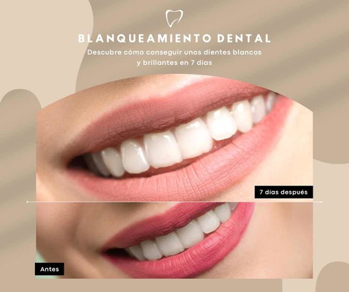 Imagen 1 de 5 de Blanqueamiento Dental, Consultorio Dental