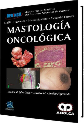 Mastologia Oncologica Silva