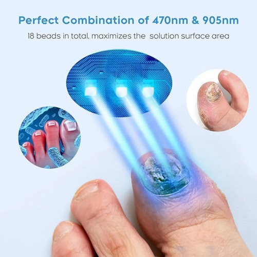 Dispositivo Láser Para Hongos En Las Uñas Para Múltiples Uña
