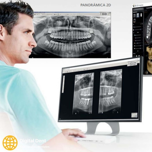 Imagen 5 de 6 de Radiografía Panorámica Dental