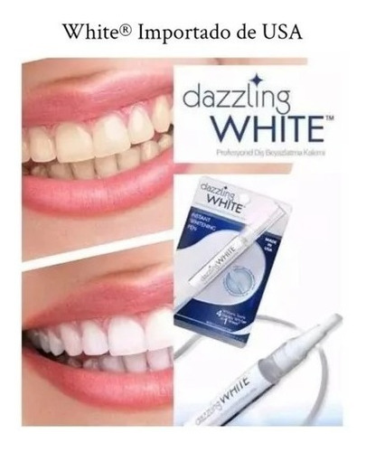 Tratamiento De Blanqueamiento Dental Dazzling White 