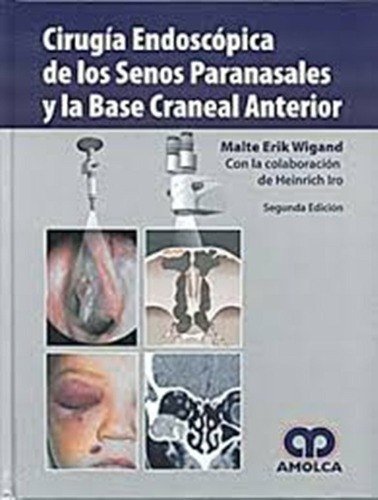 Libro - Cirugia Endoscopica De Los Senos Paranasales - Wigan
