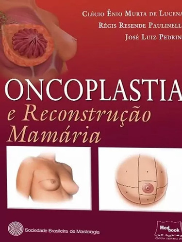 Livro: Oncoplastia E Reconstrução Mamária