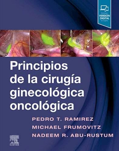 Principios De La Cirugía Ginecológica Oncológica .