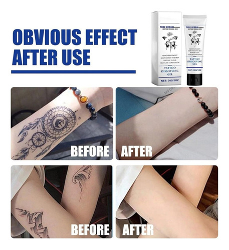 Crema Para Eliminar Tatuajes, 2 Unidades