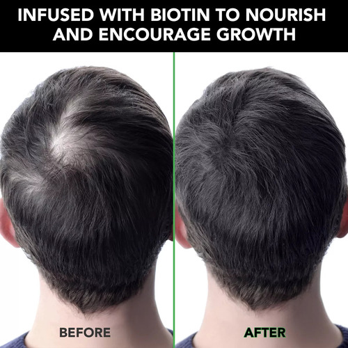 Shampoo Nutre TĂș Cabello Hasta Raiz Y Puntas Aceite Ricino