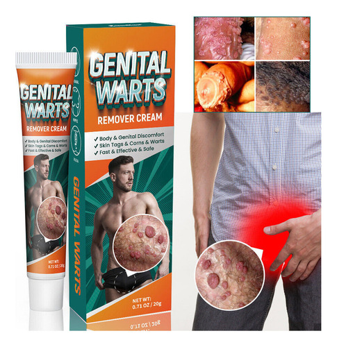 Xinnuo Pomada Para Eliminar Las Verrugas Del Herpes