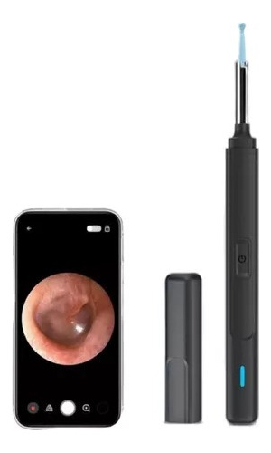 Limpiador Oídos Cámara Hd Inalámbrica Recargable Endoscopio