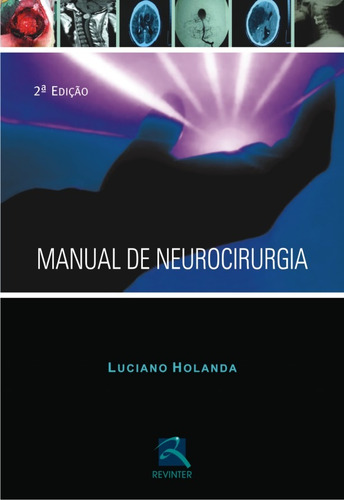 Manual de Neurocirurgia, de Holanda, Luciano. Editora Thieme Revinter Publicações Ltda, capa mole em português, 2010