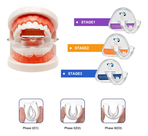 Ortodoncia Ortodoncia Retención Dental De Aparatos Dentales