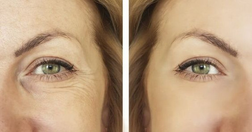 Crema Anti-age/retinol/ácido Hialurónico/+ 6 Aceites Puros
