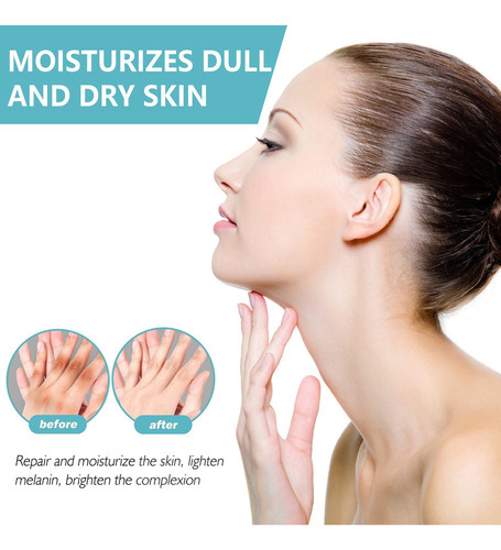 Ma 5 Unidades De Crema Tratamiento Acantosis Nigricans