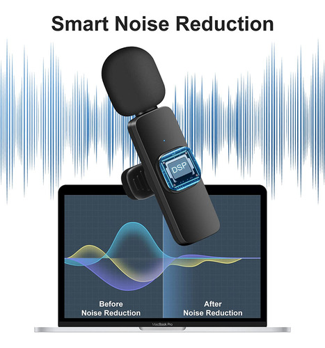 Bzxzb Wireless Microphone For Camera/computer/laptop/macbook