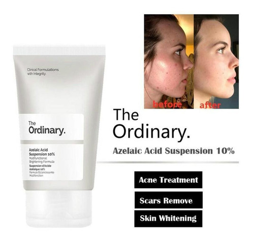 The Ordinary Azelaic Acid Suspension 10% (30ml) Melasma Acne