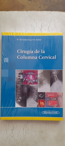 Cirugía De La Columna Cervical González Díaz / Koller