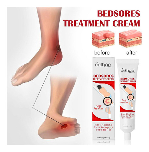 5x Crema For Llagas Por Presión Ungüento For Escaras