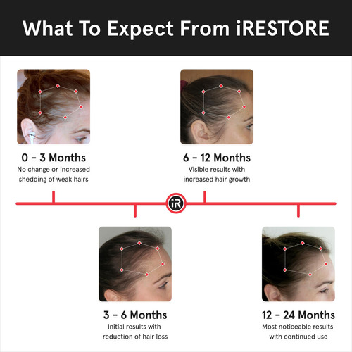 Sistema De Crescimento Capilar A Laser Irestore Professional