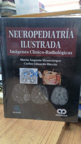 Libro Neuropediatria Ilustrada - Montenegro