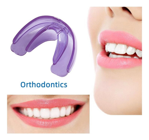 Asd Aparatos Ortodóncicos Dentales Alineación De Dientes