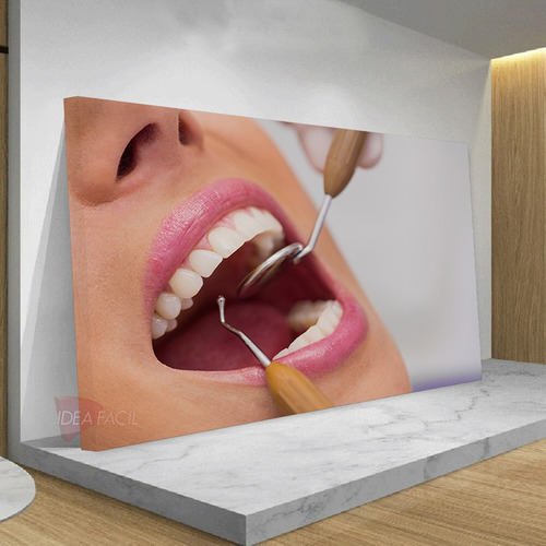 Mega Cuadro Dentista Canvas Grueso 140x90 Mdn6