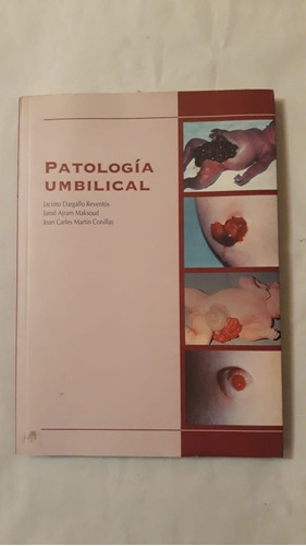 Patologia Umbilical-reventos/maksoud/conillas-ed.uriach-(35)