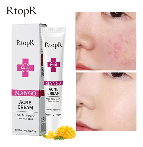 Crema Face The On Marks Acne Fades Acne Mango Rtopr