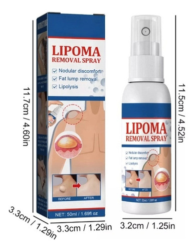 Productos Para El Cuidado De La Piel Lipoma Fatty Knot En Ae