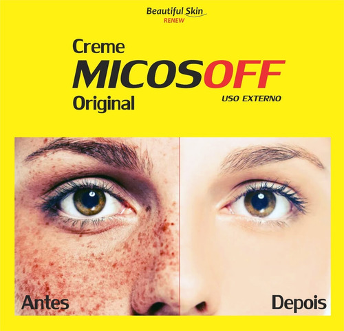 Creme Para Micose Manchas Na Pele Melasma Acne Micosoff 60g Baunilha