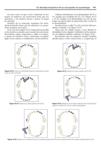 Ortopedia Funcional De Los Maxilares En Odontopediatría. Incluye E-book: Rehabilitación Neuroclusal Precoz, De Margarita Ponce Palomares. Editorial Amolca, Tapa Dura, Edición 1 En Español, 2024