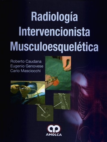 Radiología Intervencionista Musc + Radiologia Intervencinist