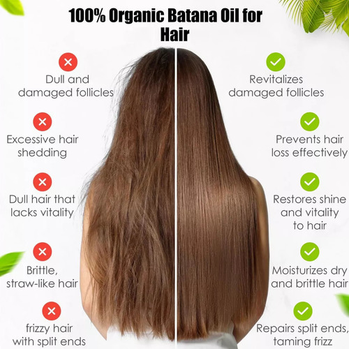 -- Aceite For El Cabello L Batana, Aceite For El Cuidado Del