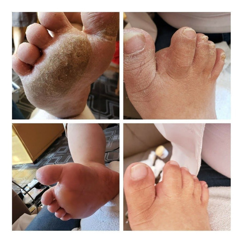 Imagem 1 de 5 de Podologia À Domicílio