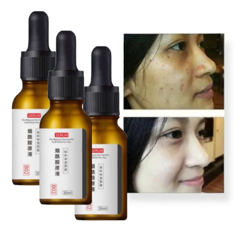 Imagen 1 de 6 de Essence Serum Suero Facial Nicotinamide Nicotina Y02 Acido H