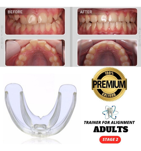 Ortodoncia Invisible En Cuotas Adultos Bracket Agnovedades
