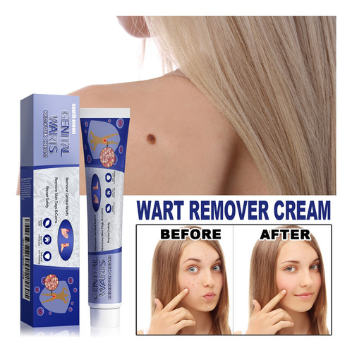 Pomada Para Remover Verrugas Causadas Por Herpes Genital