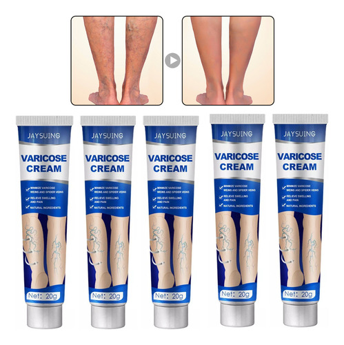 5* Crema Para Varices Spider, Tratamiento Para Varices B