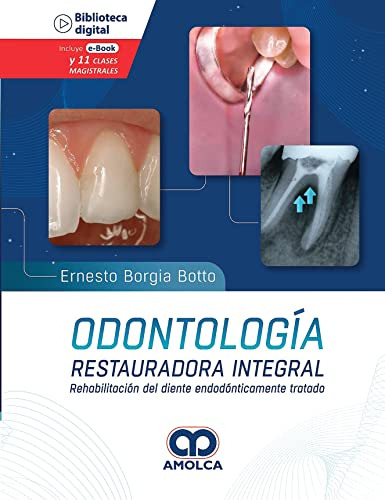 Libro Odontología Restauradora Integral Rehabilitación Del D