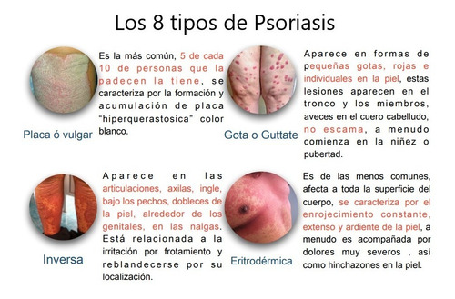 Nopsor Jab Sol, Más Suave, Pepepsor, Shampo Aux Tx Psoriasis